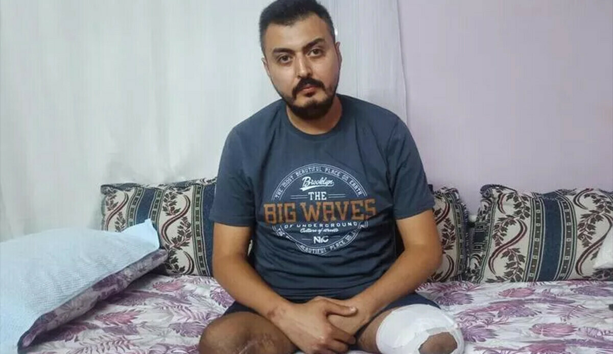 Eşi, iki çocuğu ve iki bacağını kaybetti! Depremin acı hikayesi... görseli