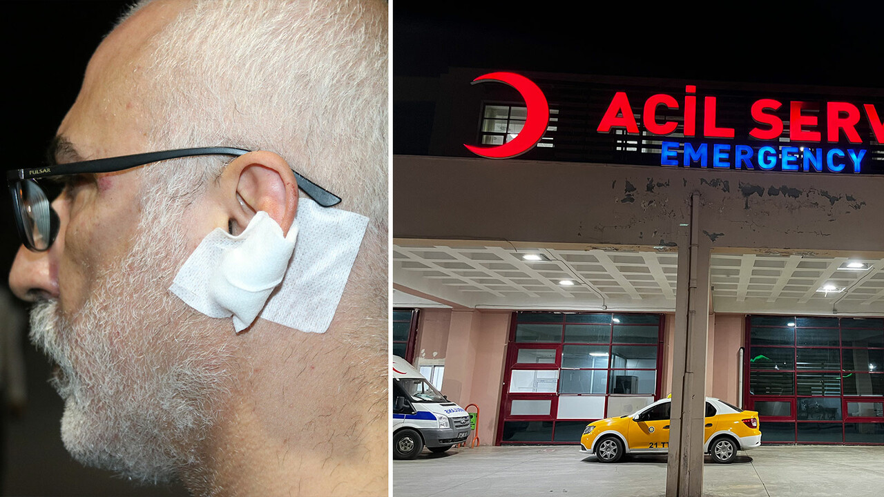 Gazeteciler Günü'nde gazeteciye yumruklu, bıçaklı saldırı! Canını zor kurtardı görseli