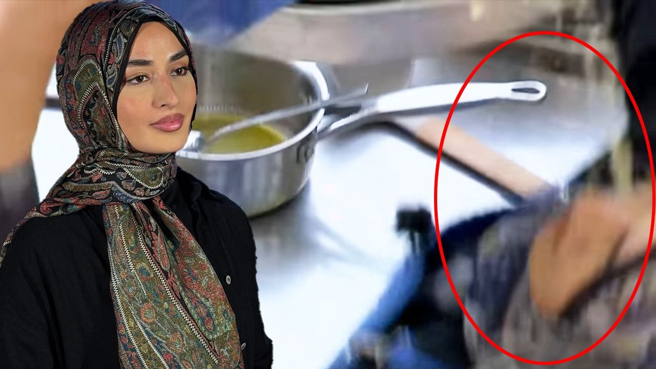 MasterChef Beyza’nın yüzüne kızgın yağ döküldü! Korkunç görüntüler yayınlandı görseli