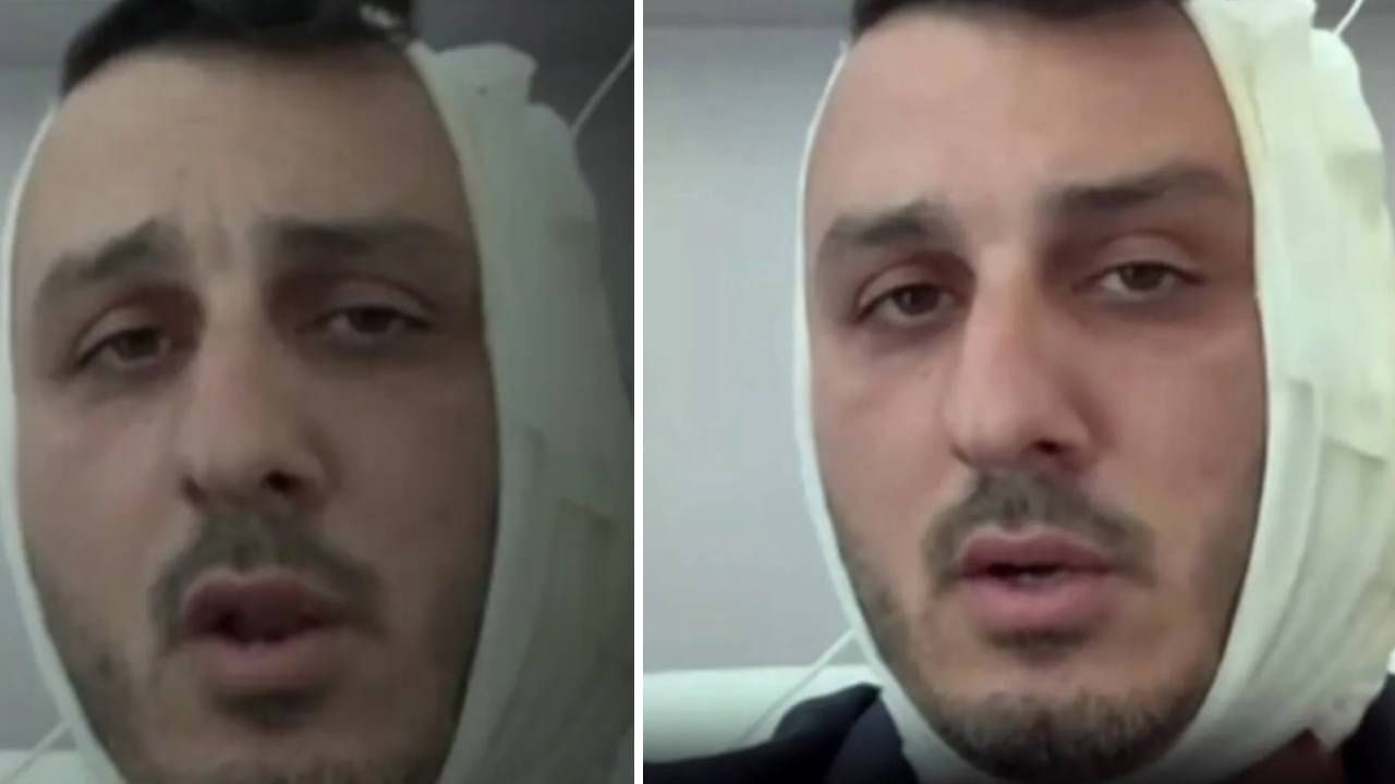 İsrailli turistin tatil keyfi kısa sürdü! Kulağını kopardılar