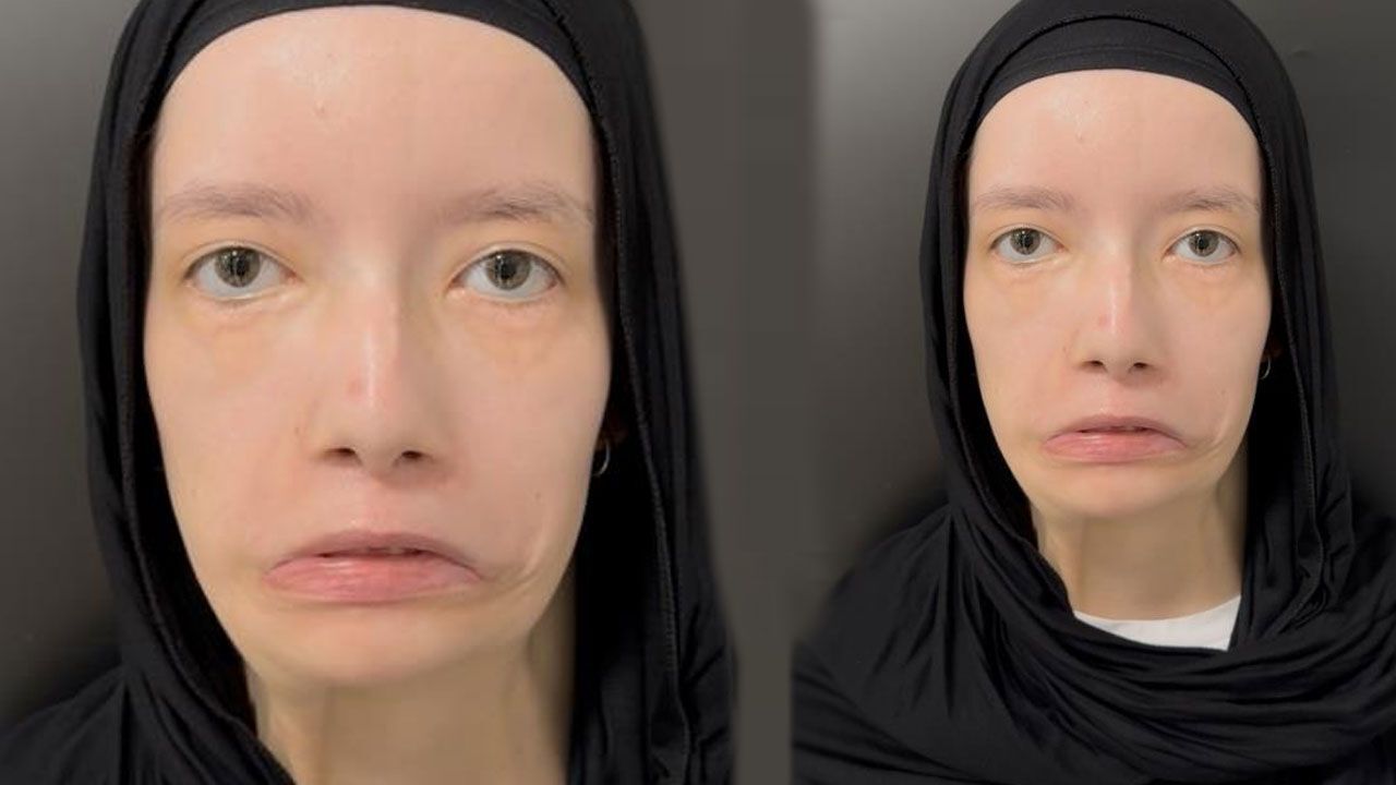 Türk doktorlar tarih yazdı! Kübra Nur 23 yıl sonra ilk kez gülümsedi