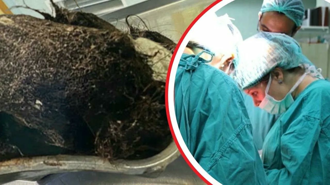 Karın ağrısı şikayetiyle gitmişti! Midesinden çıkanlar doktorları bile hayrete düşürdü: Gider deliği gibi...