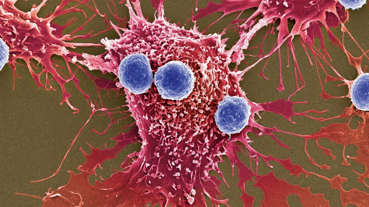 Bakteriyle kanseri yok ettiler! Bilim dünyası bu yöntemi konuşuyor