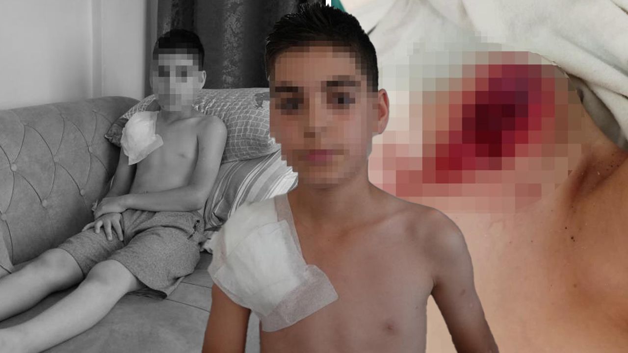 Köpek kolunu parçalamıştı! Küçük çocuğun sağ kolu felç kaldı... Aile adalet arıyor