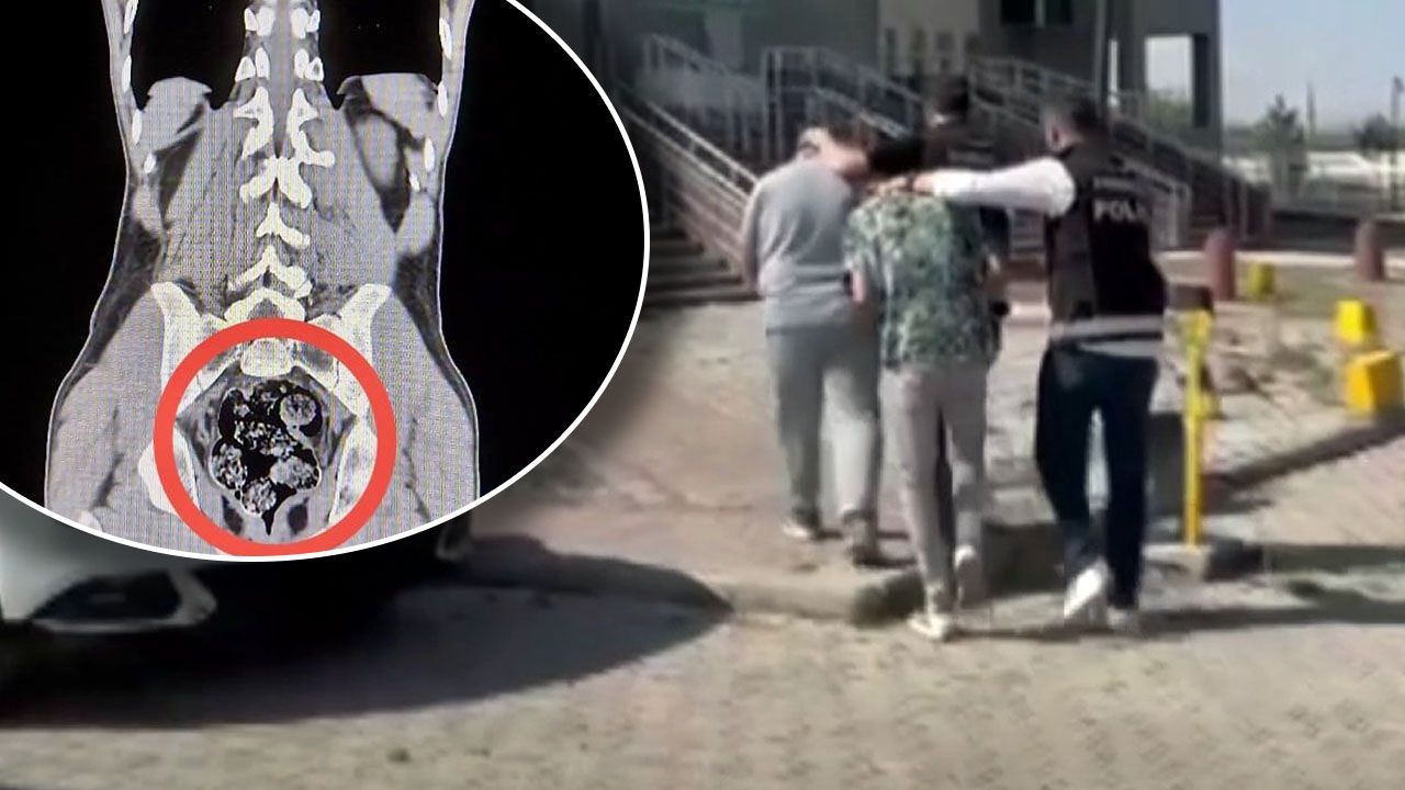 Otobüste yakalandılar, hastanede şoke ettiler! Makatından 7 parça uyuşturucu çıktı