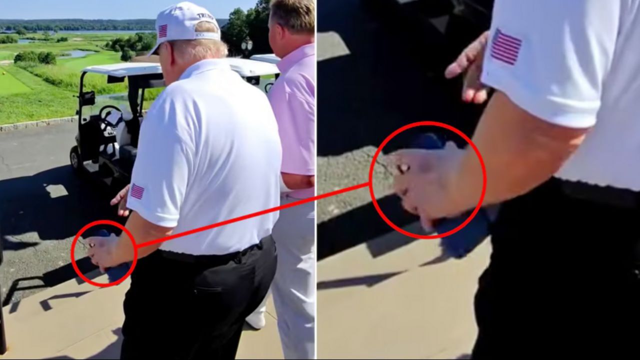 Oval Ofis’te sakladı, golf sahasında yakalandı: Trump’ın morlukları büyüyor!