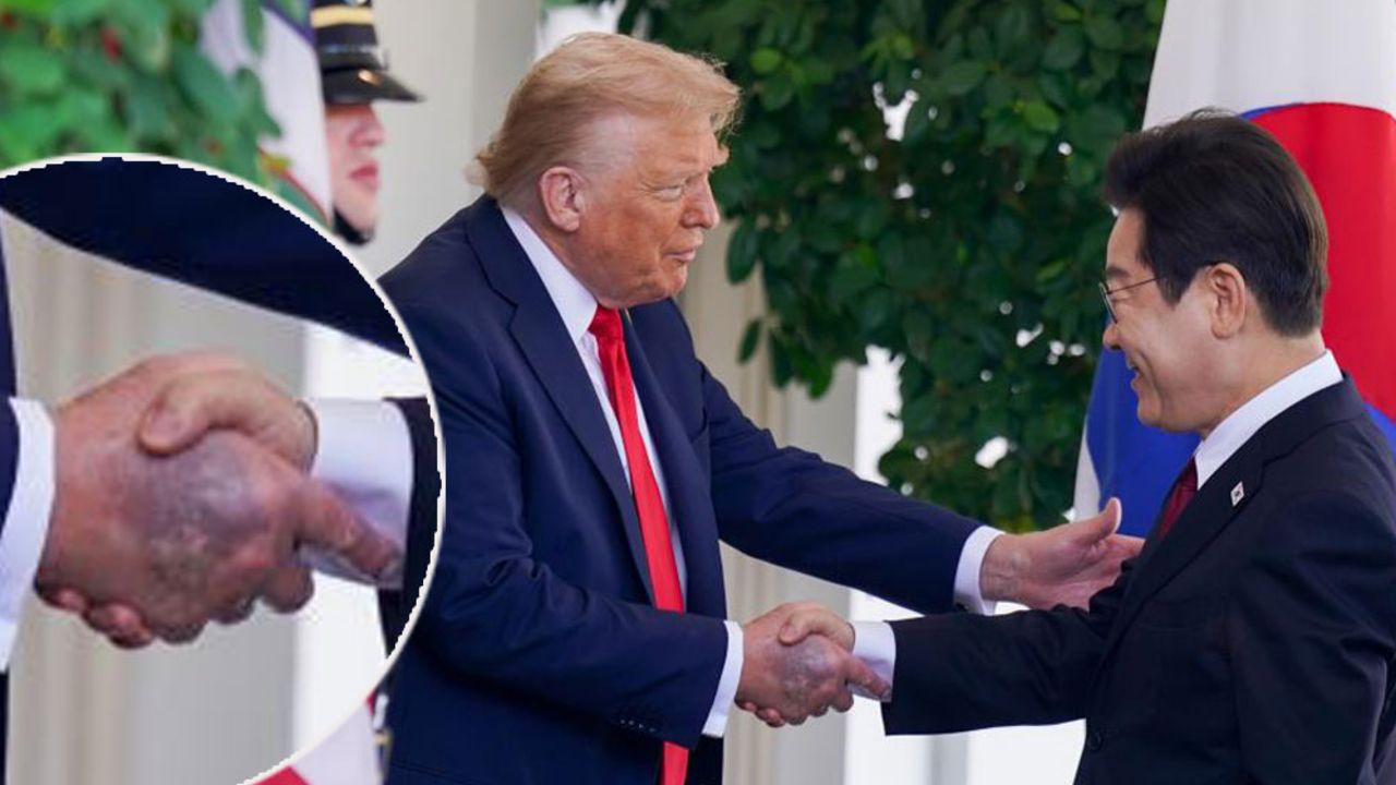 Trump’ın elindeki morlukların sebebi belli oldu! Beyaz Saray açıklama yaptı