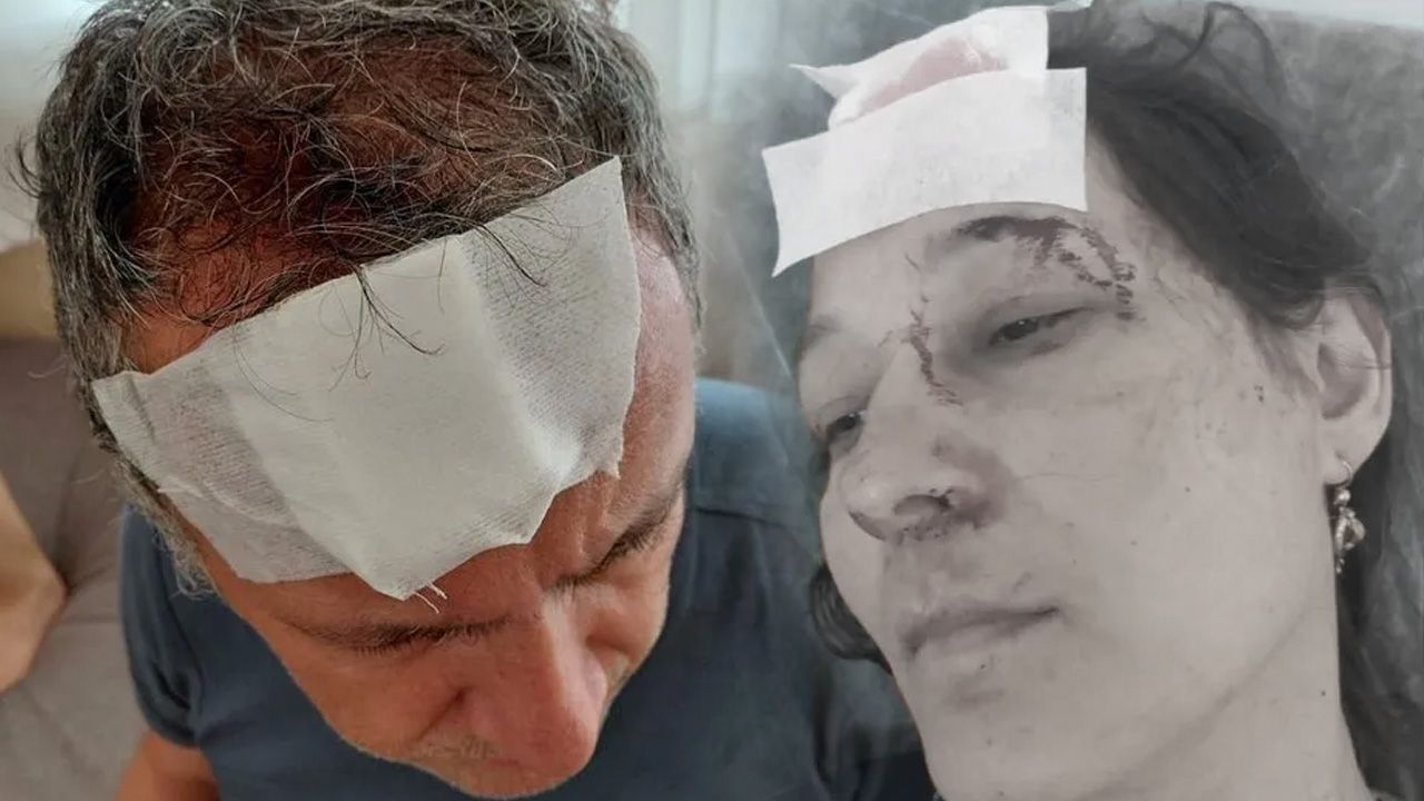 Yazlıkta 'aidat' dehşeti! Demir sopalarla acımazca dövüldüler