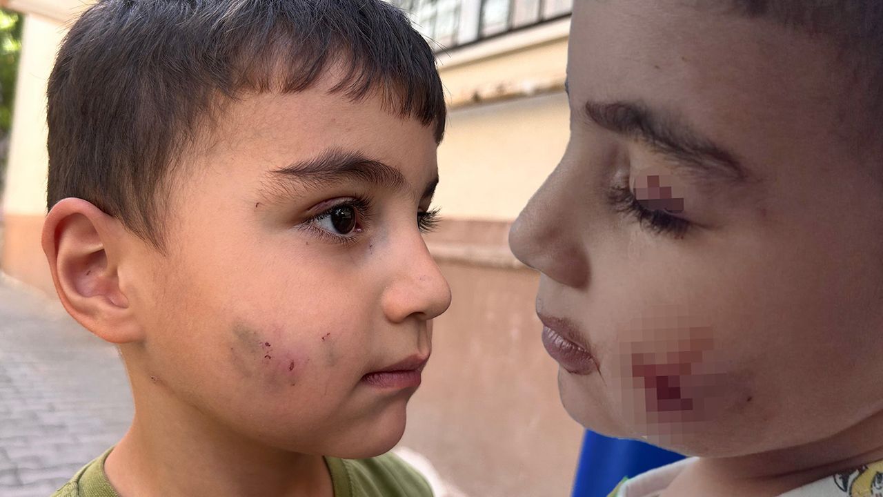 Evde uyurken farenin ısırığıyla uyandı! Küçük çocuk dehşeti yaşadı: Kanı durduramadılar