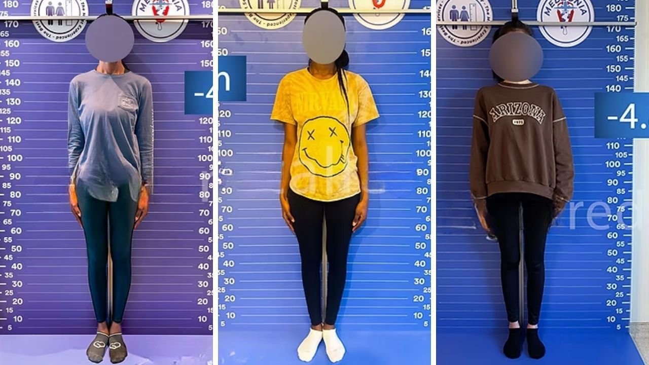 İngilizler boy kısaltmak için Türkiye’ye geliyor! Güzellik için bu da yapıldı