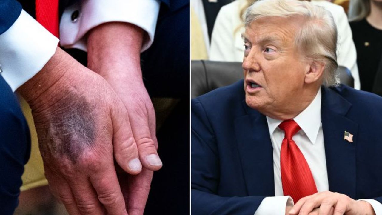 Trump kayıp mı? Hastalandı iddiası ABD’yi karıştırdı