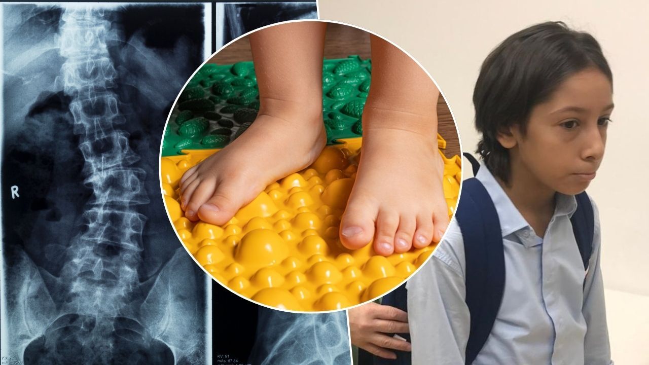 Sadece omurga değil, ayaklar da tehlikede! Uzmanlardan uyardı: Her yıl söyleniyor ama veliler dikkat etmiyor