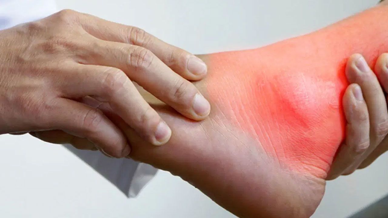 Dikkat, şiddetli ağrıyla başlıyor… Çorap dahi giymeyi zorlaştırıyor