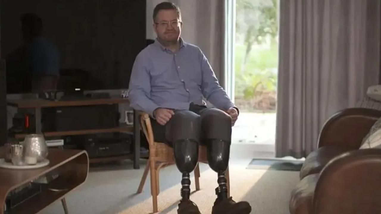 Hastaları endişe içinde! Dolandırıcılık için bacaklarını kestiren cerrahın cezası belli oldu