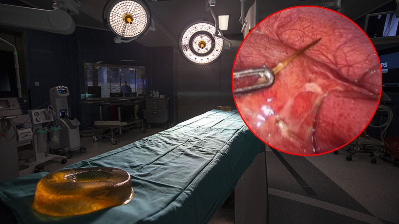 Tavuk yemeği sonrası hastanelik oldu! Gerçek ameliyatta ortaya çıktı
