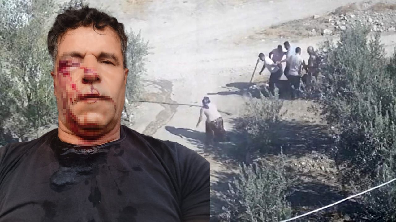 Kafasını taşla ezmek istediler! Kocasını akrabalarından böyle kurtardı