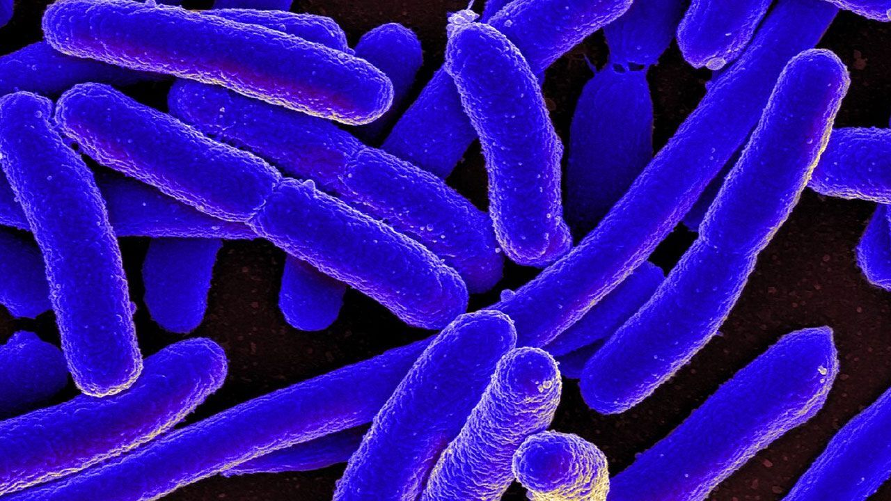 Dirençli bakterilere karşı yapay zeka silahı! Tedavide yeni dönem başlıyor