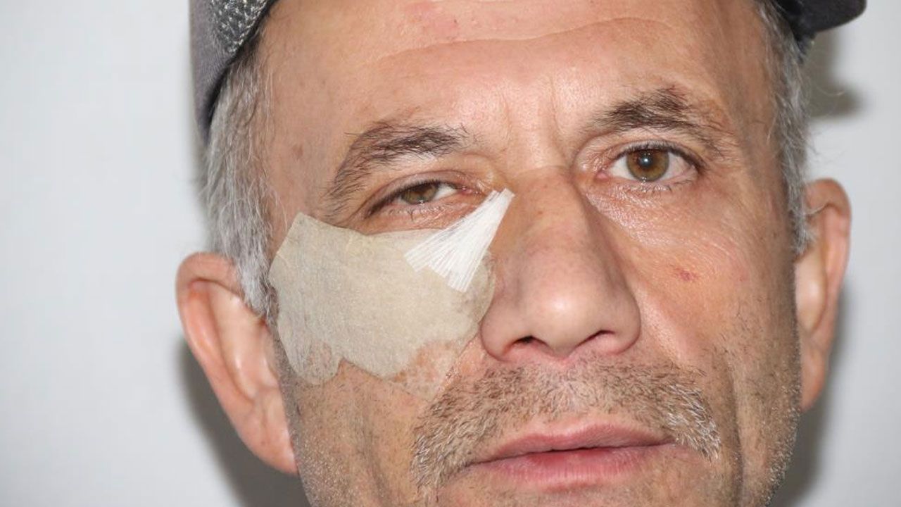 Cami yolunda dehşet: Komşusu darp etti! “Elmacık kemiğim çökmüş”