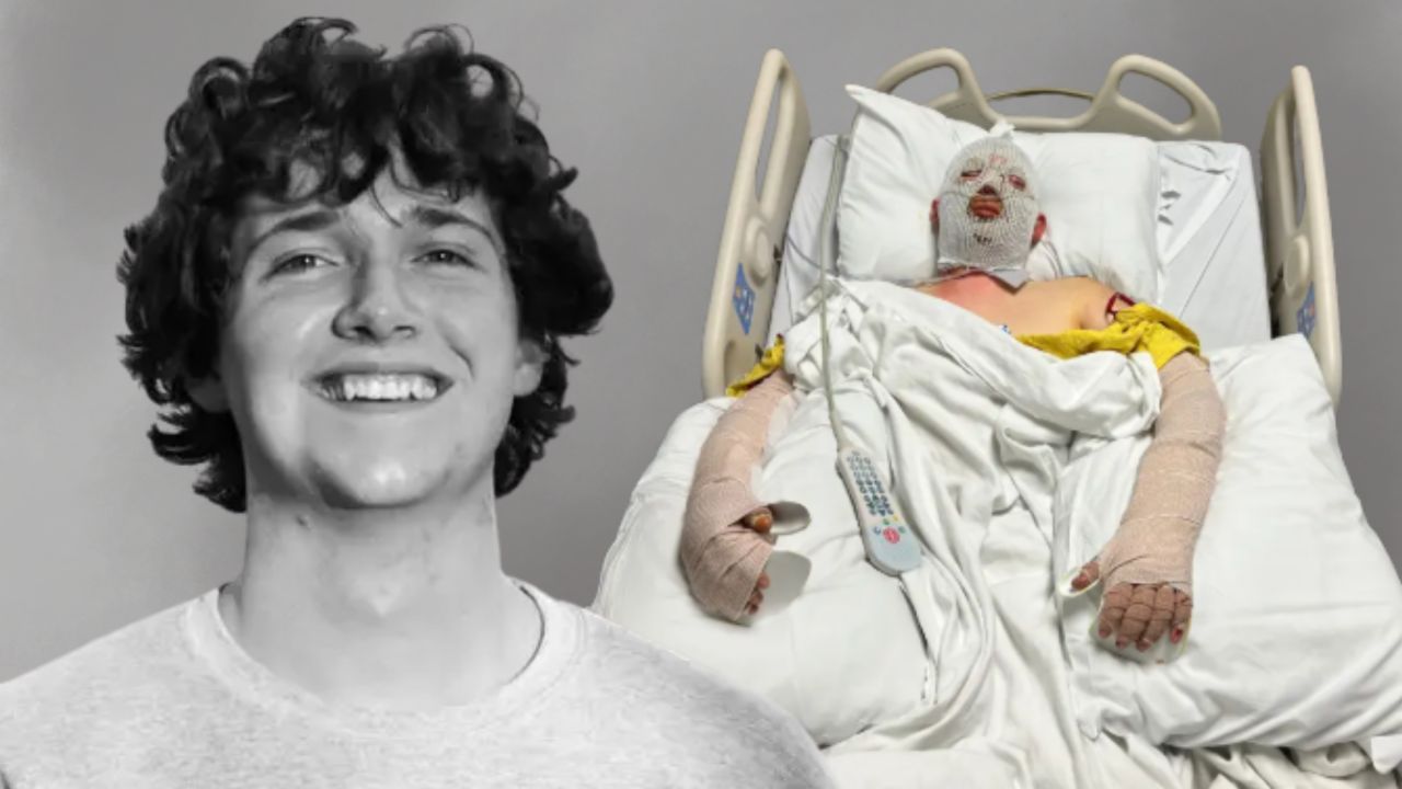 ABD'de alkollü sürücü dehşeti! Aracın benzin deposu patladı, 19 yaşındaki genç kabusu yaşadı