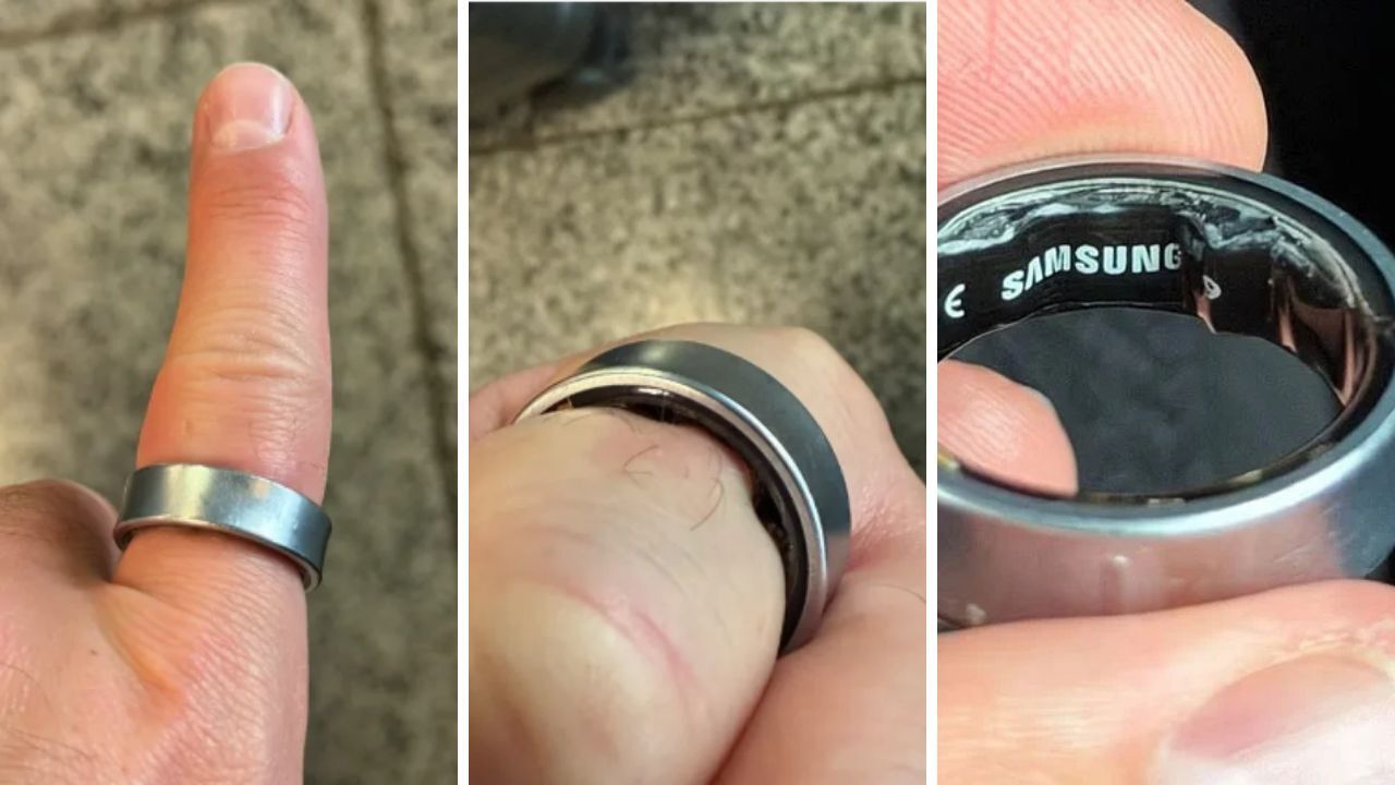 Ünlü YouTuber akıllı yüzüğü yüzünden hastanelik oldu! O anları sosyal medya hesabından paylaştı