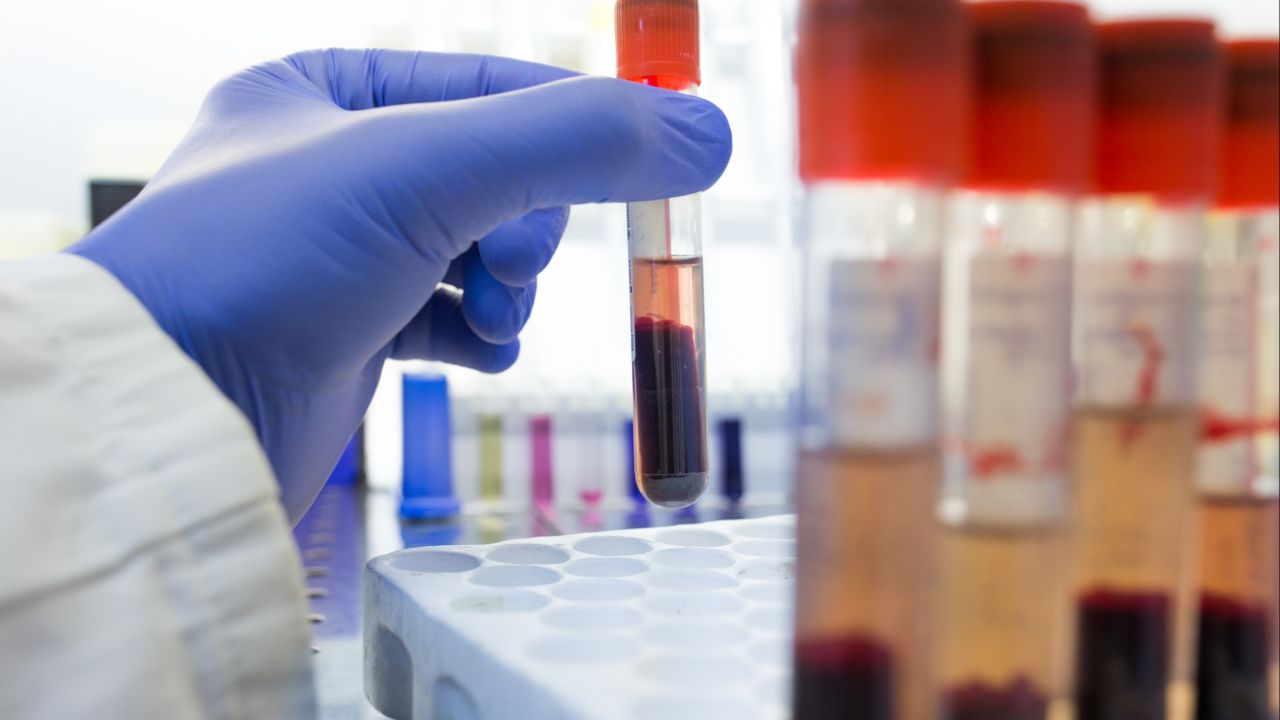 Türkiye kanser enstitüsü başkanı Prof. Dr. Civelek: Gereksiz kolonoskopiyi engelleyecek tarama testi