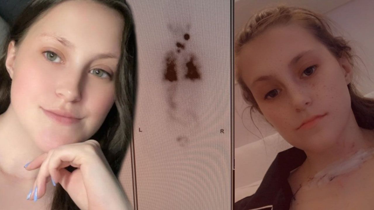 Cildindeki döküntüyle gitti… Doktorun dikkati sayesinde 5 yıllık gizli hastalığı ortaya çıktı