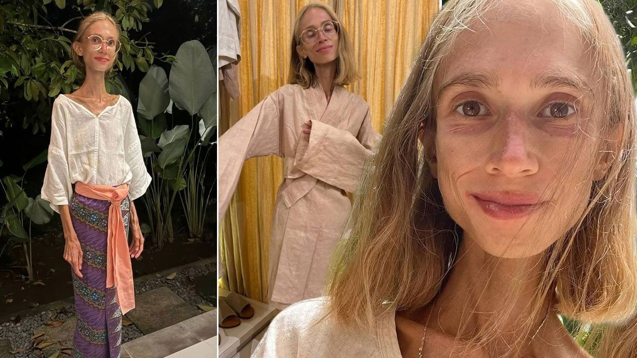 Uyguladığı meyve diyeti sonu oldu! 22 kiloya düşen fenomen otelde ölü bulundu