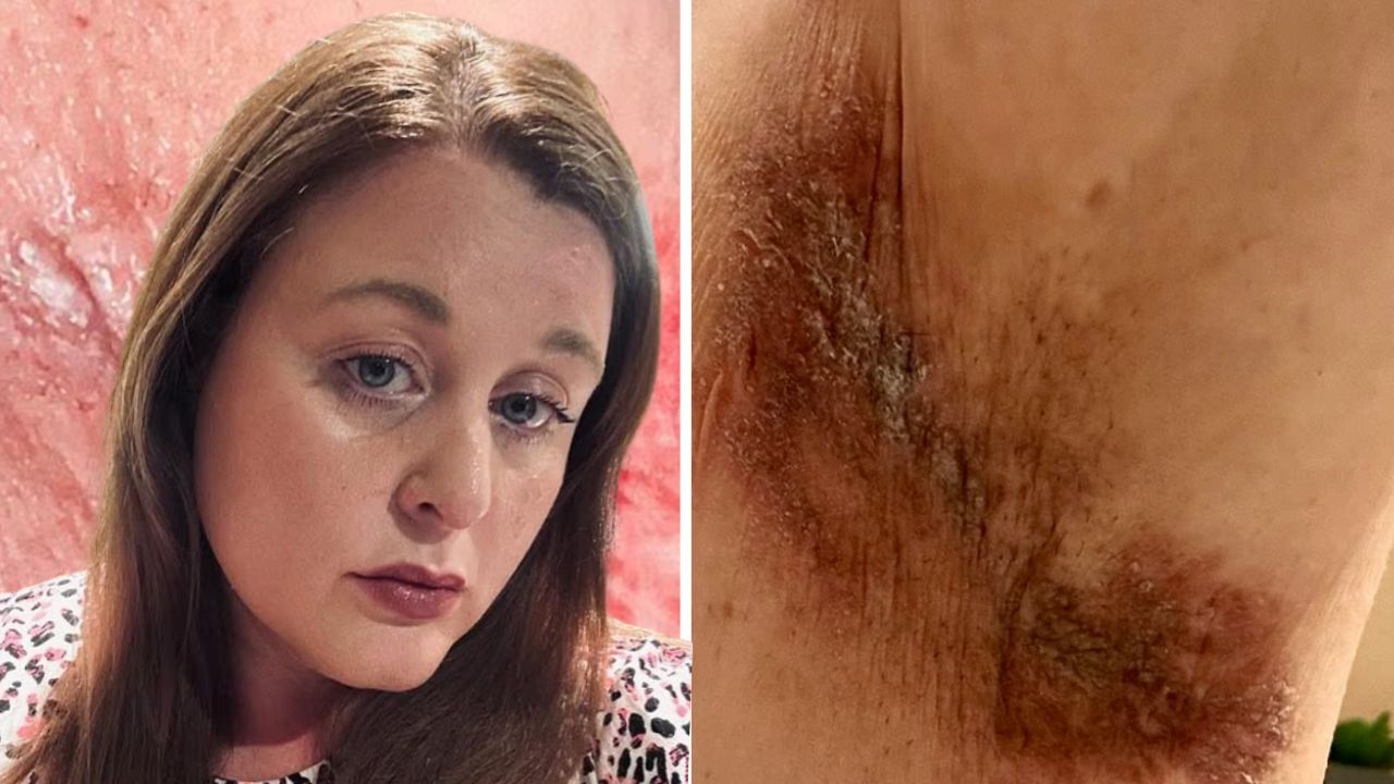 Ünlü markanın deodorantı ciltlerini yaktı! Yüzlerce kadın kabusu yaşadı