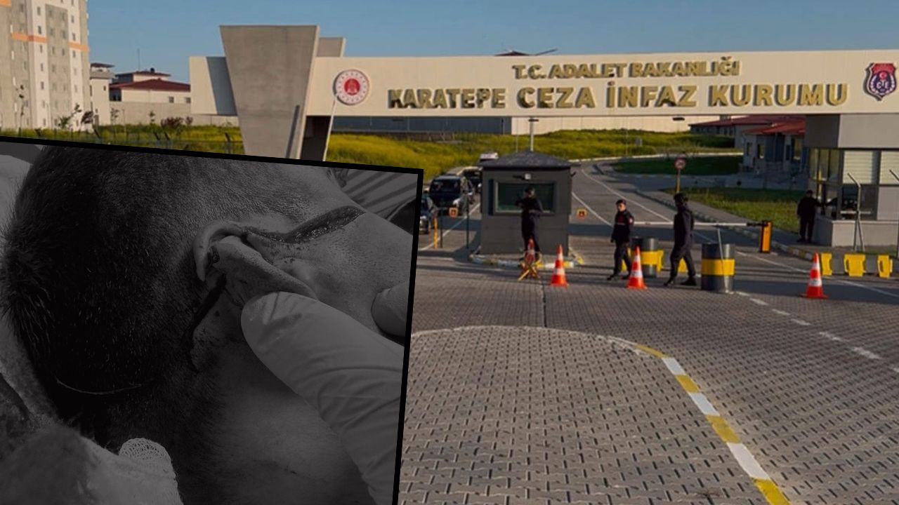 Karatepe Yüksek Güvenlikli Ceza İnfaz Kurumunda dehşet! Mahkum 3 memuru bıçakladı