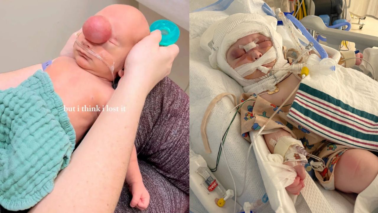 Alnında sıvı dolu balonla doğdu! Tıp tarihine geçti