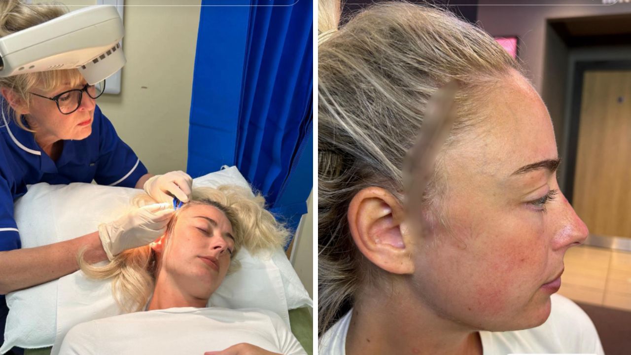 Anksiyete teşhisi konmuştu, gerçek nöbet geçirince ortaya çıktı! 