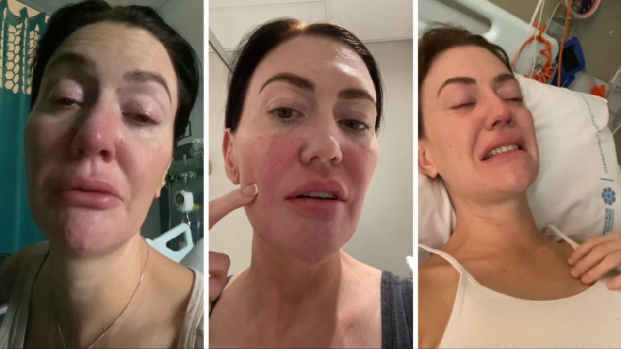 Mide ağrısını aylarca görmezden geldi, acı gerçek hastanede ortaya çıktı! "Vücudumun verdiği bir sinyalmiş"