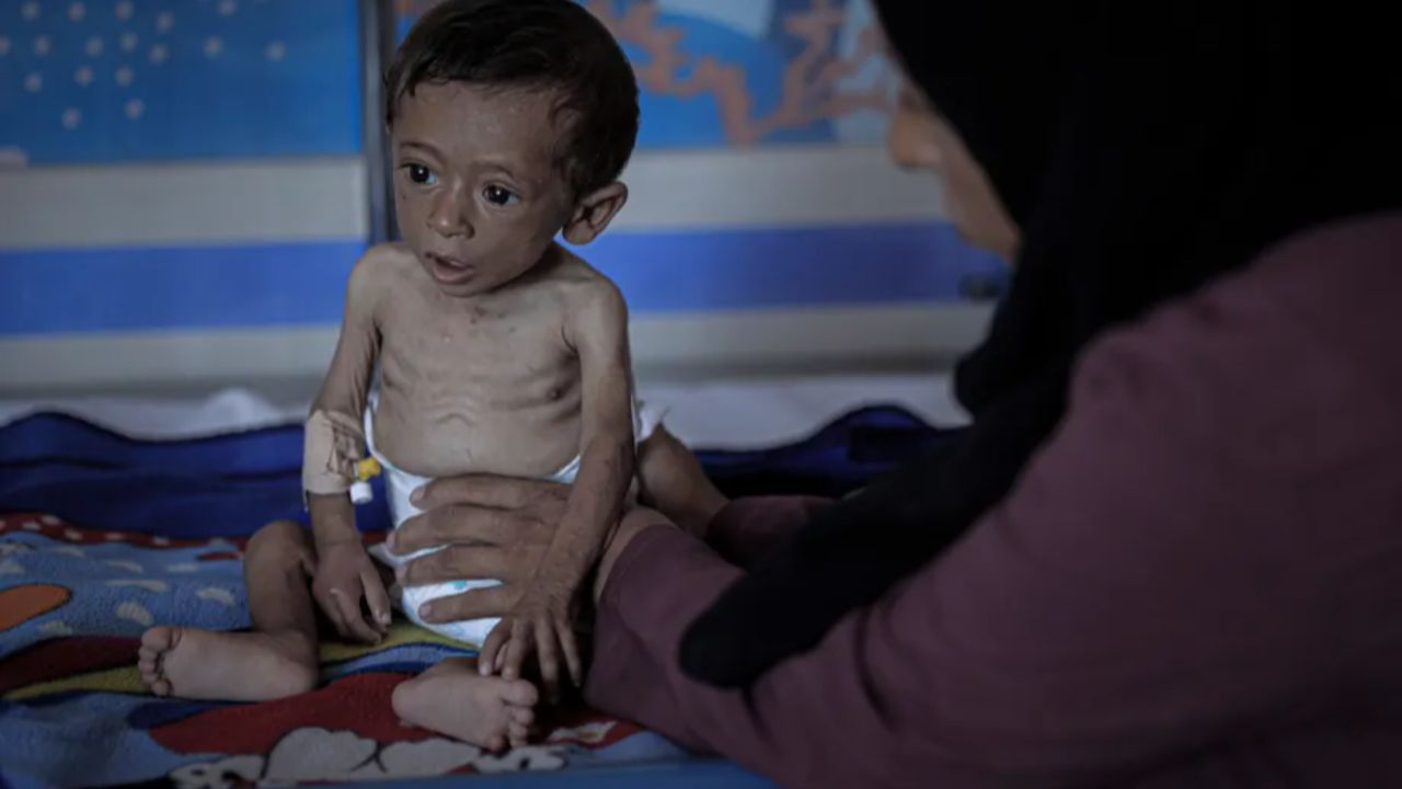 Vicdanları sızlatan ret! Almanya, Gazze’den gelen çocukları kabul etmedi