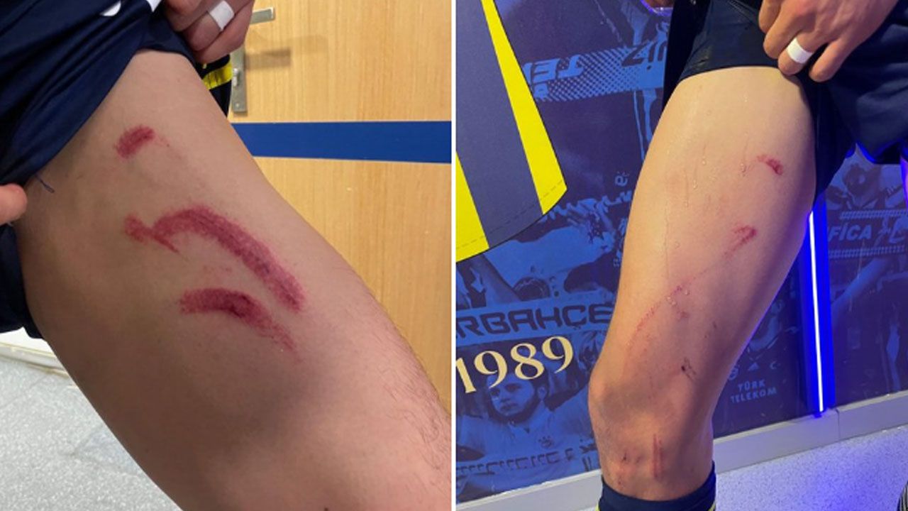 Fenerbahçe - Stuttgart maçında çıldırtan karar: Kırmızı kart beklentisi