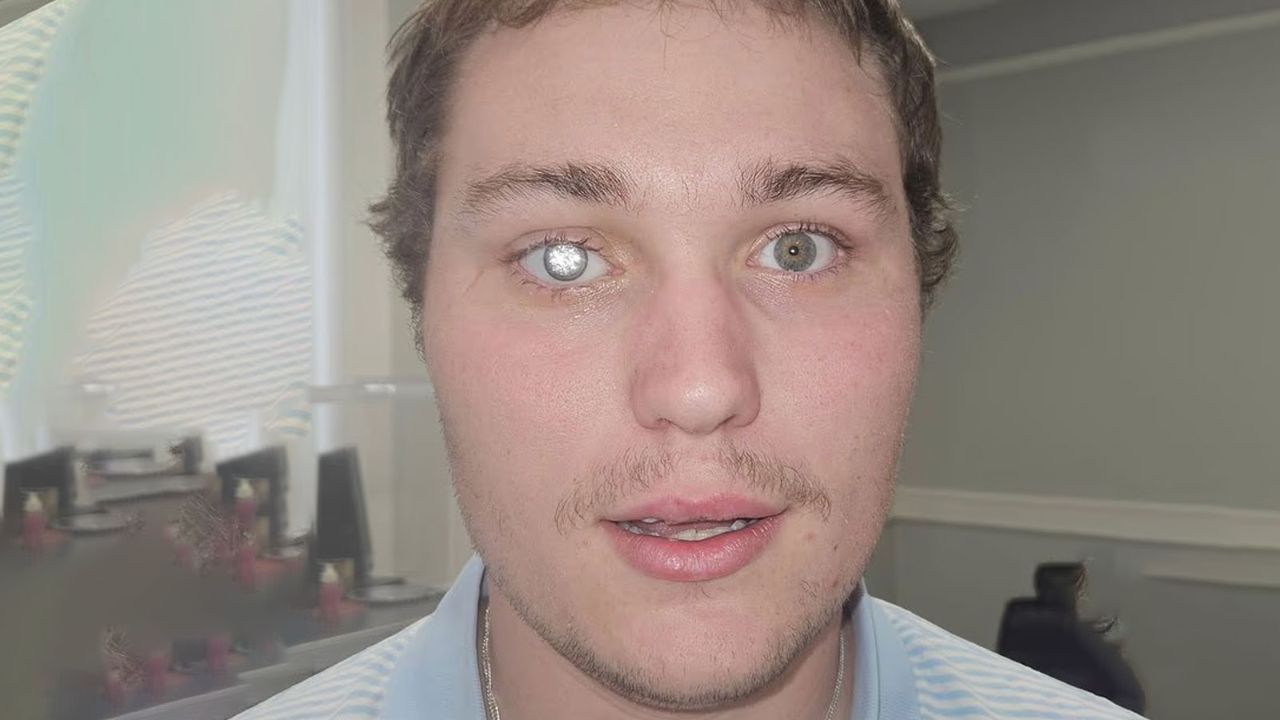 Protez gözüne elmas taktırdı