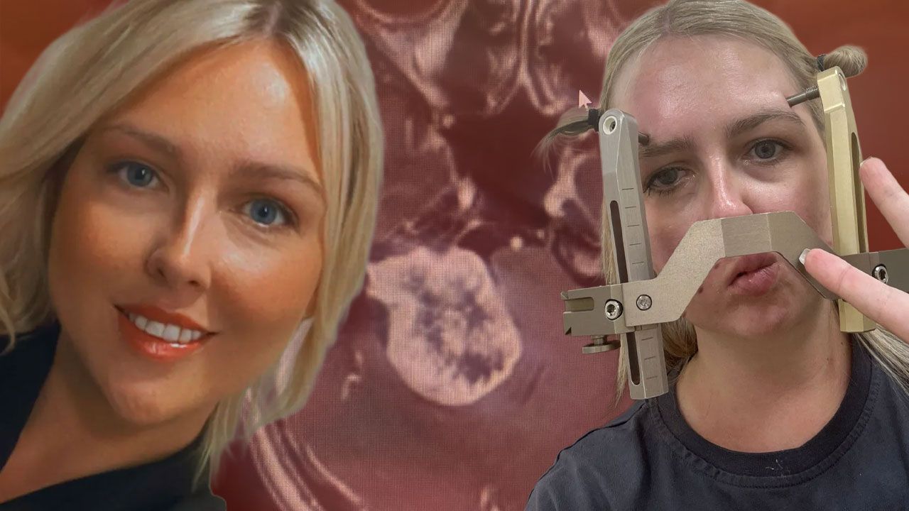 Baş ağrısını yıllarca hafife aldılar! Gördüğü ‘küçük kurtlar’ gerçek sorunu ele verdi