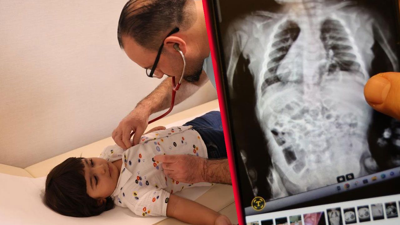 Küçük çocuğun bağırsakları göğüs boşluğuna çıkmış! Gizli hastalığı ortaya çıktı