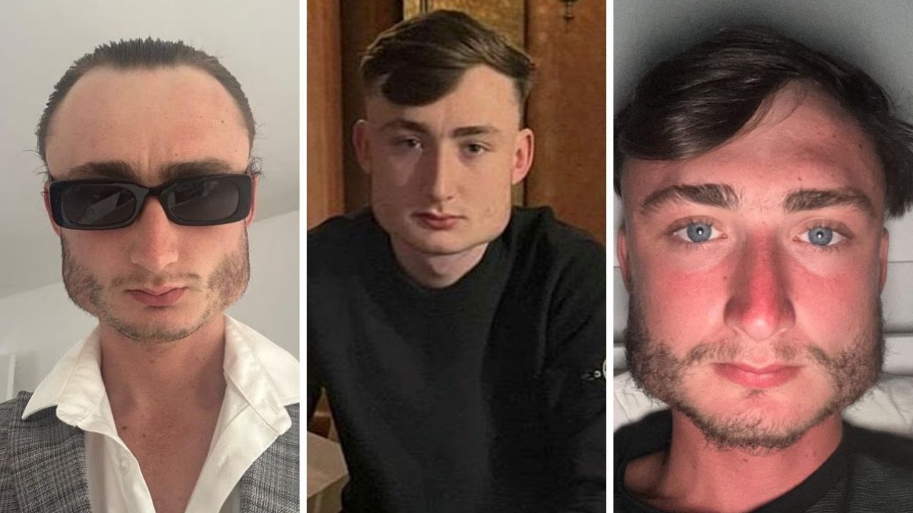 Sosyal medya onu konuşuyor! Yaptığı spor yüzünün şeklini değiştirdi