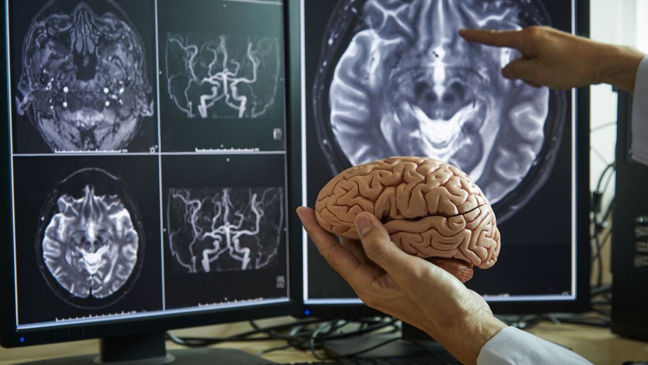 Beyin yaşlanmasını yavaşlatıyor! Bilim insanları 86 bin kişiyi inceledi ve...