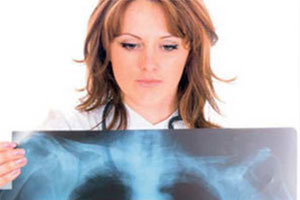 Kansere servet ödedik görseli