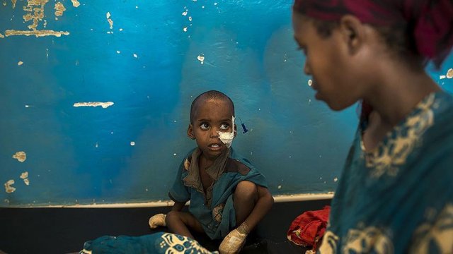 Somali halkının son umudu Türkiye görseli