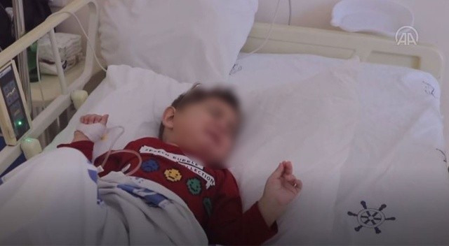 Küçük çocuğun midesinden 17 mıknatıs çıktı görseli