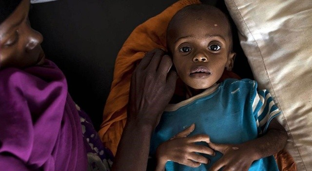 Somali'de kuraklık nedeniyle 3 kişi öldü görseli