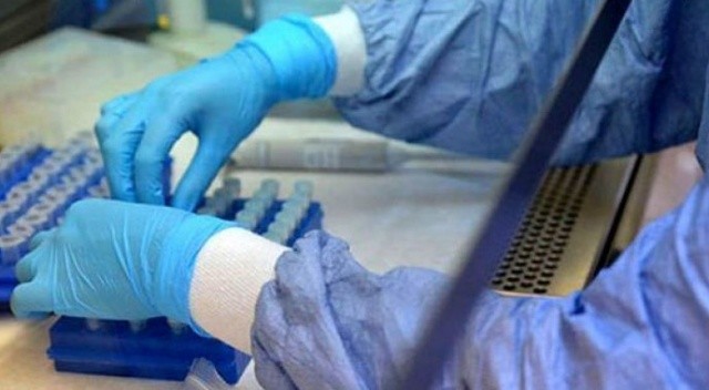 Güney Kore'de korona vakası rekor seviyede görseli