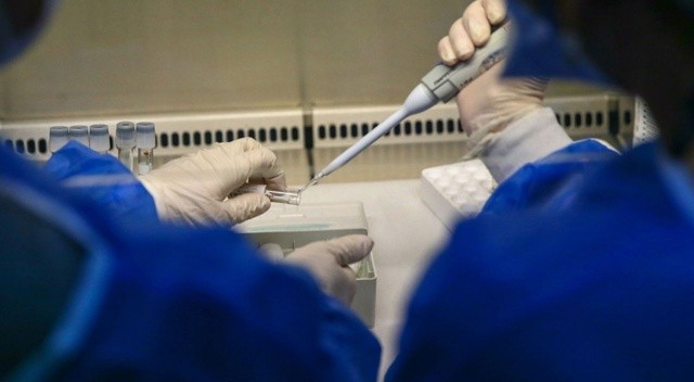 ABD’de yaşayan Türk profesör geliştirdi: Covid-19’un hiçbir varyantı bu yöntemden kaçamıyor görseli