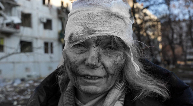 Ukrayna'nın simgesi olan yaralı öğretmen Rusların hedef tahtasına oturdu görseli