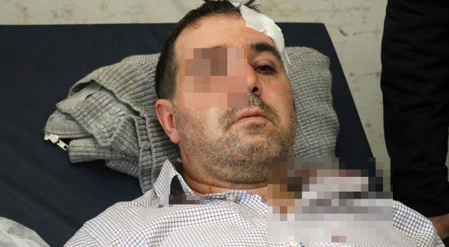 Hasta ‘Beni taciz, rahatsız ediyorsun’ diyerek doktorun burnunu kırdı görseli