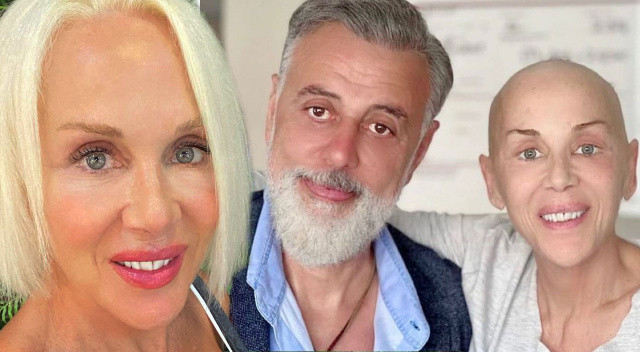 Akciğer kanserine yakalanan Billur Kalkavan’dan ilk açıklama: Herkese bir ricası var görseli