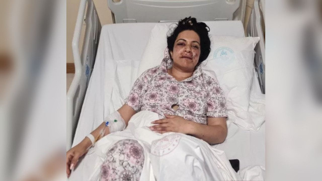 Akılalmaz olay! Eltilerin kıskançlık kavgası: Silahla ağzından vuruldu görseli