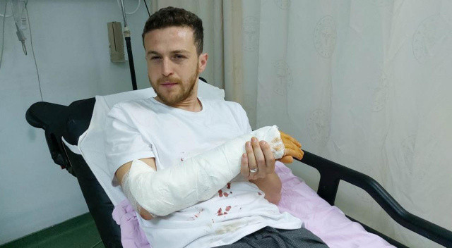 Bayram ziyareti için gitti, sokak köpeğinin saldırısına uğradı görseli